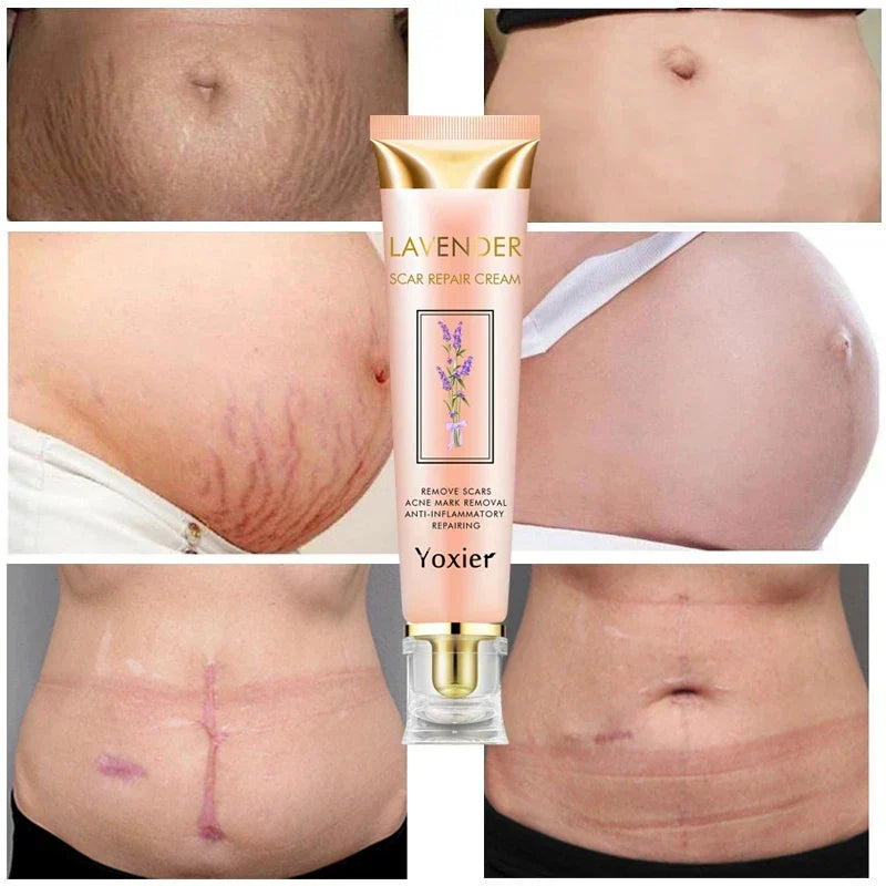 Crème réparatrice des imperfections