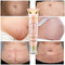 Crème réparatrice des imperfections
