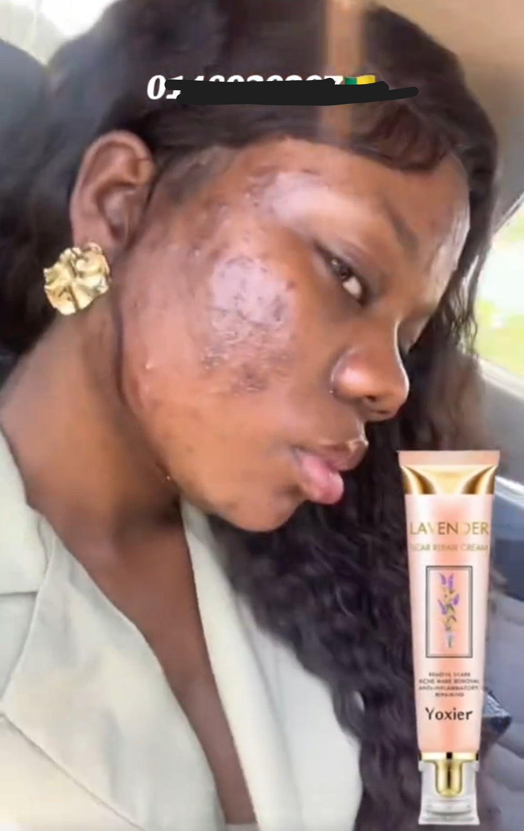Crème réparatrice des imperfections