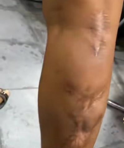 Crème réparatrice des imperfections