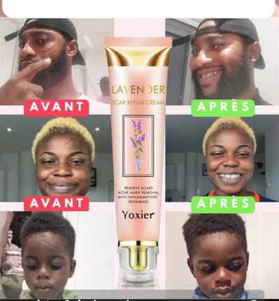 Crème réparatrice des imperfections